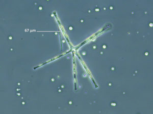 Cellule phytoplanctonique présente dans les plans d'eau